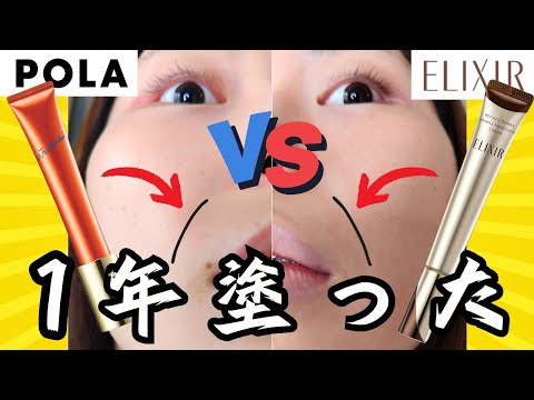 【シワ改善対決！】POLAリンクルショット VS エリクシールリンクルクリーム１年塗った結果