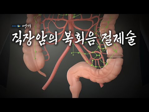 [명의 의학백과📖] 직장암의 복회음 절제술