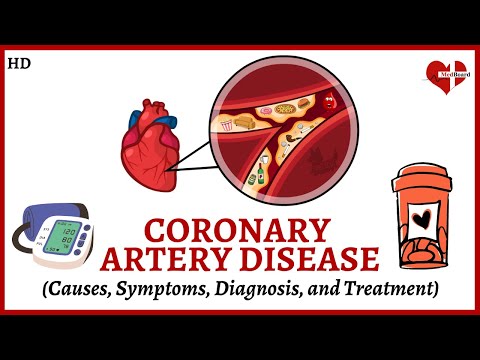 Coronary Artery Disease: What It Is, What Causes It, and How to Treat It