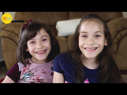 Conjoined Twins Who Were Separated (A Miraculous Story)