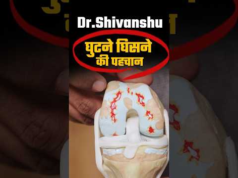 क्या घुटनों से आने लगी है कट-कट की आवाज | Time to Replace Your Knee |  #shorts