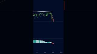 Master Trading Setups: Your Ultimate Guide to Profit 📈 #DayTrading #TradingTips #Forex