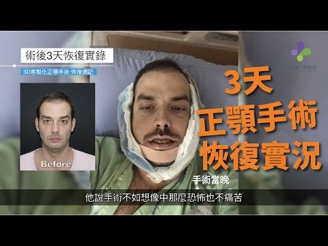 改善下顎後縮-謝明吉醫師正顎手術後3天回診紀錄