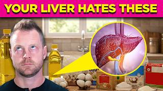 7 Foods That RUIN Your Liver & Block Weight Loss