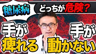 【糖尿病/高血圧】脳梗塞？手が動かない・痺れ危険見極めポイントとは