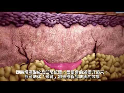 sculptra 舒顏萃 X 朵特菈診所