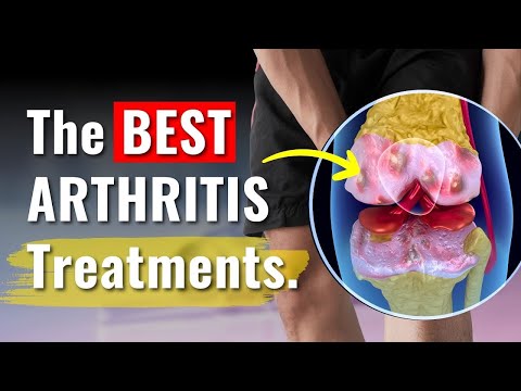 Knee Arthritis Treatments Proven to Work - The Truth You Need to Know