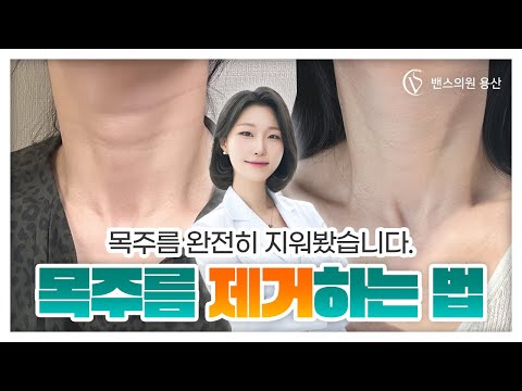 목주름 없애는 법? 밴스 용산점에서 목주름 완전히 지워봤습니다🔥