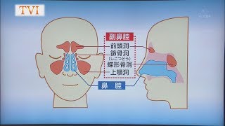 いわて元気○（マル）　【鼻の病気「副鼻腔炎」】（2018/8/7放送ニュースプラス１いわて）