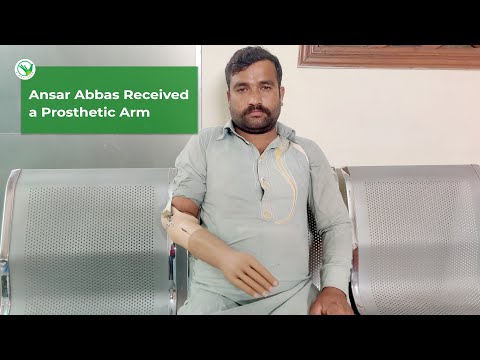 Ansar Abbas was Overjoyed to Receive an Artificial Arm