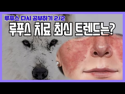 [루푸스 다시 공부하기] 루푸스 치료 최신 트렌드는?(2/2)