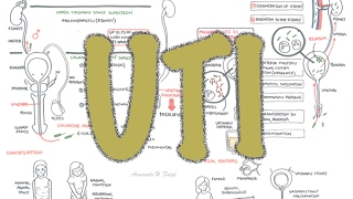 Urinary Tract Infection - Overview (signs and symptoms, pathophysiology, causes and treatment)