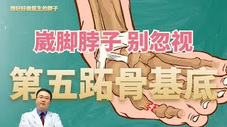 崴脚脖子后很容易漏诊的一种骨折：第五跖骨基底部骨折，请看过来