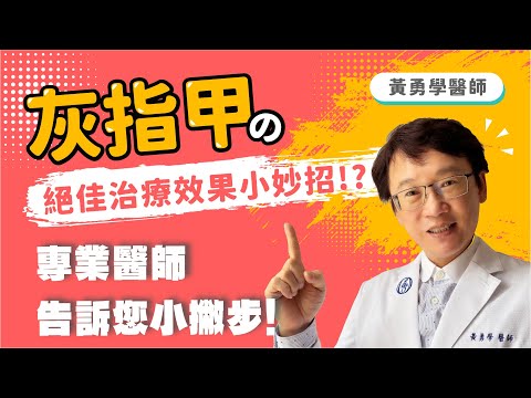 灰指甲的絕佳治療小撇步!?讓專業醫師告訴你!