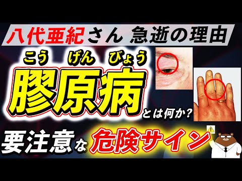 放置厳禁！知らないと後悔する「膠原病」が引き起こす体の変化。なぜ八代亜紀さんは急逝したのか。初期の危険サインとは？医師が徹底解説！