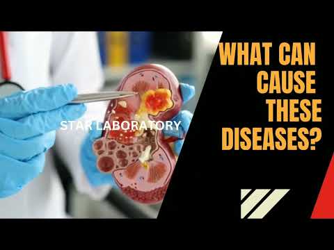 Promo video: 05 Dangerous Kidney Diseases in English | Never ignore these diseases