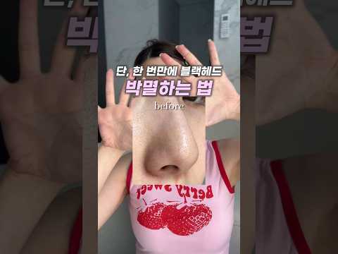 단 한 번만에 블랙헤드 박멸하는 방법👃🏻 딸기코 안녕~~🍓👋🏻