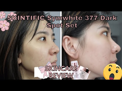 SKINTIFIC Symwhite 377 Dark Spot Serum & Moisturizer Review 2024