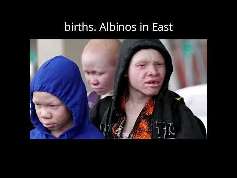 Africa’s Island of Albinos #Africa #African #Albino #Tanzania #Genetics