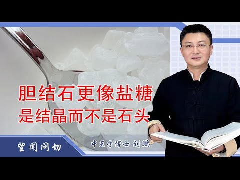 胆结石更像盐糖，并非石头，方法用对是可以化开的