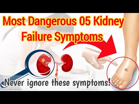 Most 05 dangerous kidney failure symptoms | Never ignore these symptoms | STAR LABORATORY