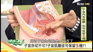 別搞混了！子宮肌腺症和子宮肌瘤不一樣！健康2.0