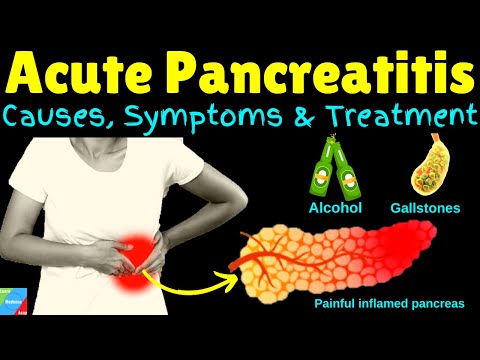 Pancreatitis (Acute Pancreatitis) – Symptoms, Causes, Diagnosis, Treatment & Prevention