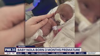 Baby Nola born 3 months premature