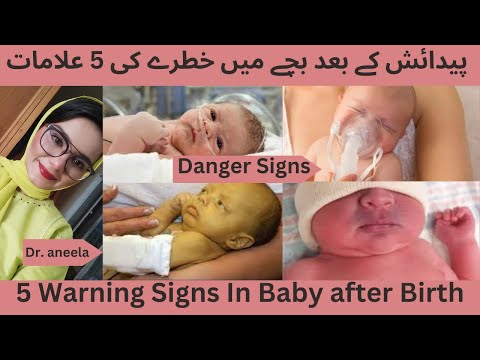 5 Warning & Dangers signs in Baby after Birth | जन्म के बाद बच्चे में 5 चेतावनी और खतरे के संकेत