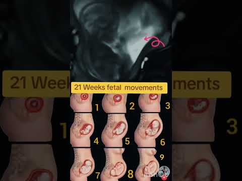 21 Weeks fetal movements #babyultrasound #fetalkicks #babymovement