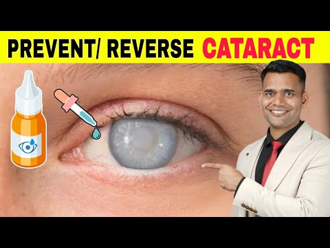 Prevent / Reverse Cataract Naturally | 2 Best Ayurvedic Remedies..... Cataract