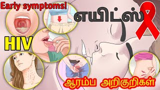 AIDS symptoms in Tamil/AIDS in Tamil/hiv explained in tamil/aids explained tamil/hiv symptoms tamil