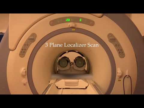 MRI Sounds Explained - 3 Plane Localizer and Auto Prescan