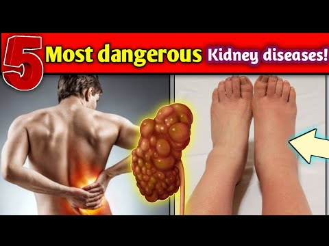 05 Most dangerous Kidney diseases! | Never ignore these kidney disease | STAR LABORATORY