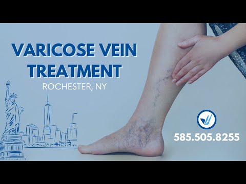 Our Vein Treatment Center in Rochester, NY