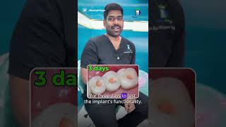 ஏன் டாக்டர் ஓட்ட பல்ல வச்சி விட்டீங்க? - Screw Access Hole | Dr.Karthikeyan | Denta Kings