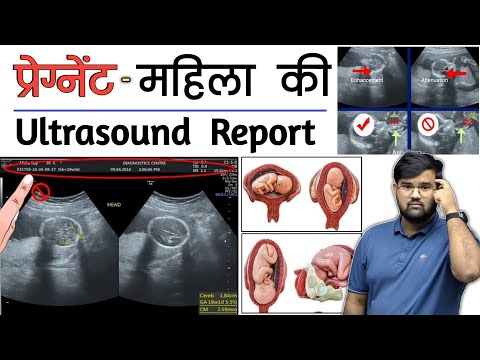 Pregnancy Ultrasound | Ultrasound Report | Medical | Doctor | MBBS | BHMS | BAMS | Nursing