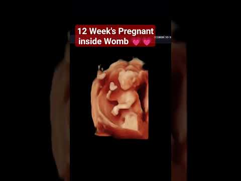 12 Week's Pregnant 5d ultrasound #babyultrasound #pregnancy