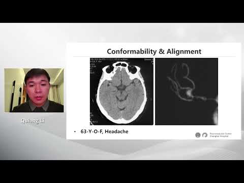 Stent assisted coiling of aneurysms in small vessels with the Leo Baby stent