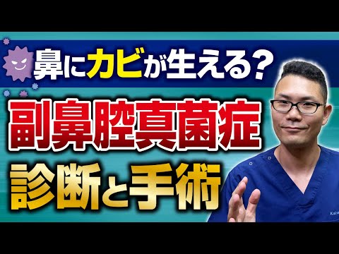 【副鼻腔真菌症】鼻にカビが生える副鼻腔炎　診断と治療　/名古屋の耳鼻科医解説