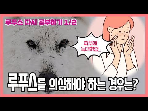 [루푸스 다시 공부하기] 루푸스를 의심해야 하는 경우는? (1/2)