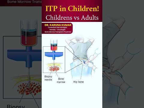 ITP in Children! | बच्चों में  ITP! Childrens vs Adults#itp #platelets #purpura  #hematologist