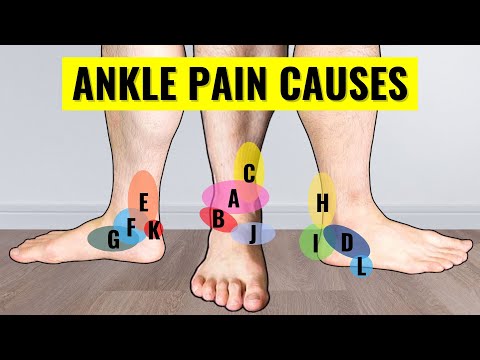 Here's Why Your Ankle Hurts - Ankle Pain Problems & Types by Location