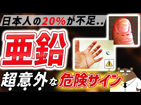 うつ、性機能..絶対に見逃してはいけない「亜鉛不足」が引き起こす超意外な体の変化。皮ふ、爪、腸..危険なサインとは？亜鉛の効果的な摂取方法とは？吸収をじゃまする超意外な食べ物とは。医師が完全解説！