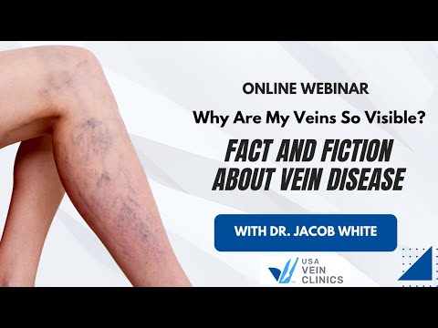 Why Are My Veins So Visible? Facts and Fiction About Vein Disease with Dr. Jacob White