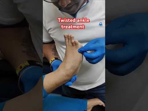 Twisted ankle treatment #drrajneeshkant #worldfamouschiropractor