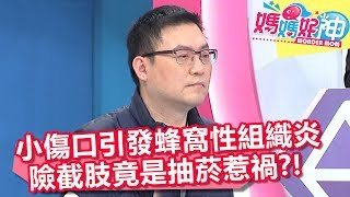 小傷口引發蜂窩性組織炎，病患險截肢竟是「抽菸」惹禍？！【媽媽好神】20190305 part4/4 EP407 江坤俊 陳櫻文