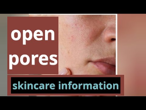 open pores treatment #openporestreatment#openporeshomeremedy #openporescream !skincare information .