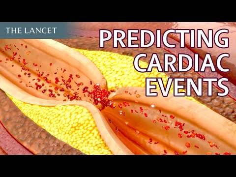 Inflammatory risk and cardiovascular events in patients without obstructive coronary artery disease