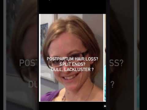 Struggle with postpartum hair loss?  Message me, I can help! #healthyhairsolutions